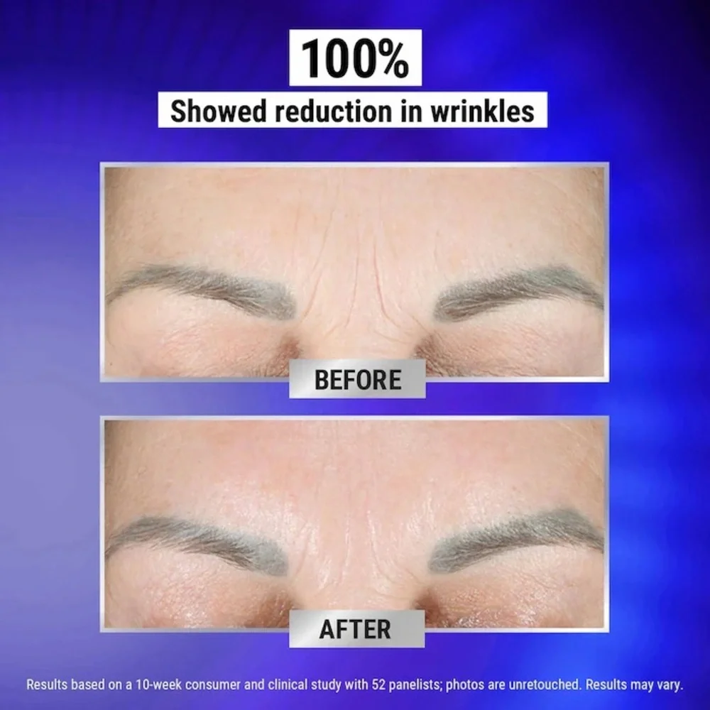 🆕 KIEHL’S Retinol Fast Release Wrinkle-Reducing Night Serum NIB / Sealed